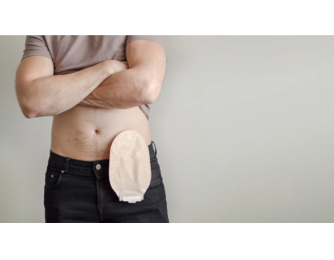 How to choose and where to buy a urostomy bag