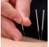 Sterile needles for acupuncture 0.30 x 50 (1000 pcs.), SAN-30-50-1000