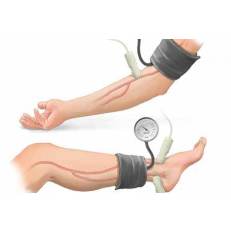 Lower limb blood pressure cuff 