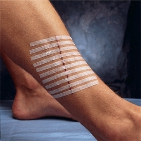 Sterile Strip plaster 12*100 №6 R1547
